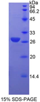 ACTA2 / Smooth Muscle Actin Protein (Recombinant His-T7)