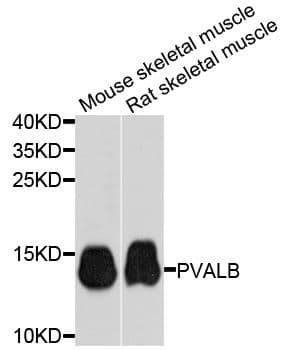 IHC-plus™ PVALB / Parvalbumin Antibody
