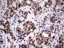 NBN / Nibrin Antibody (clone OTI6H7)