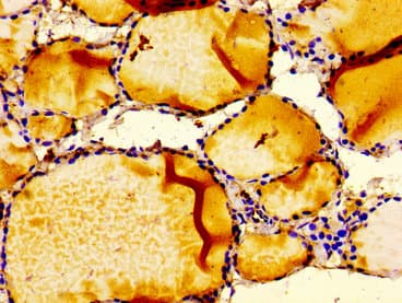 IGFBP6 Antibody