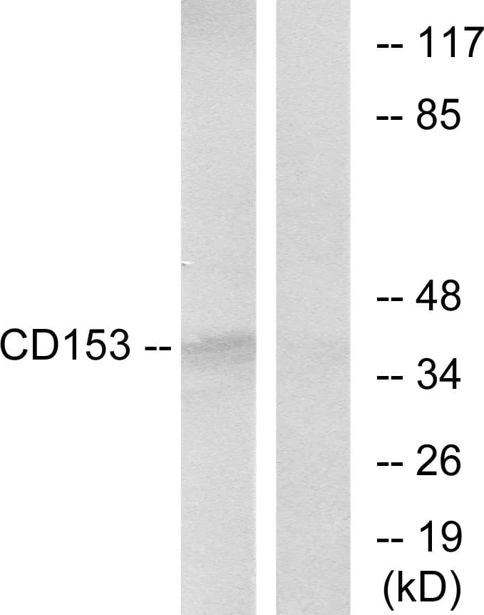Polyclonal Rabbit anti-Human CD30L / CD153 Antibody (aa71-120, WB)