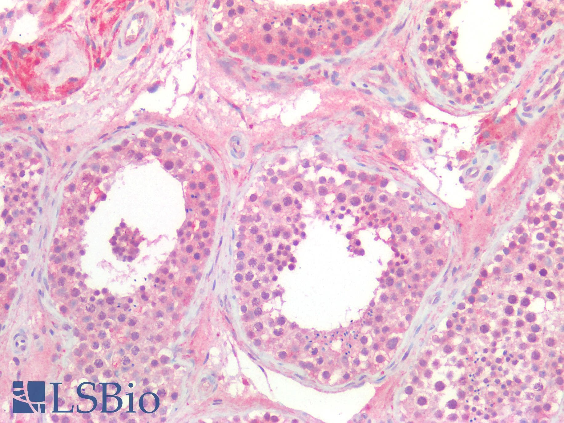 PathPlus™ Polyclonal Rabbit anti-Human CD276 / B7-H3 Antibody (IHC)