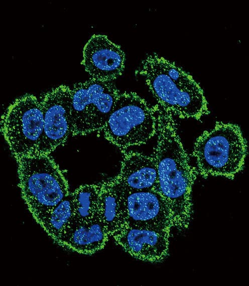 Polyclonal Rabbit anti-Human PLAU / Urokinase / uPA Antibody (aa396-426, IHC, IF, WB)