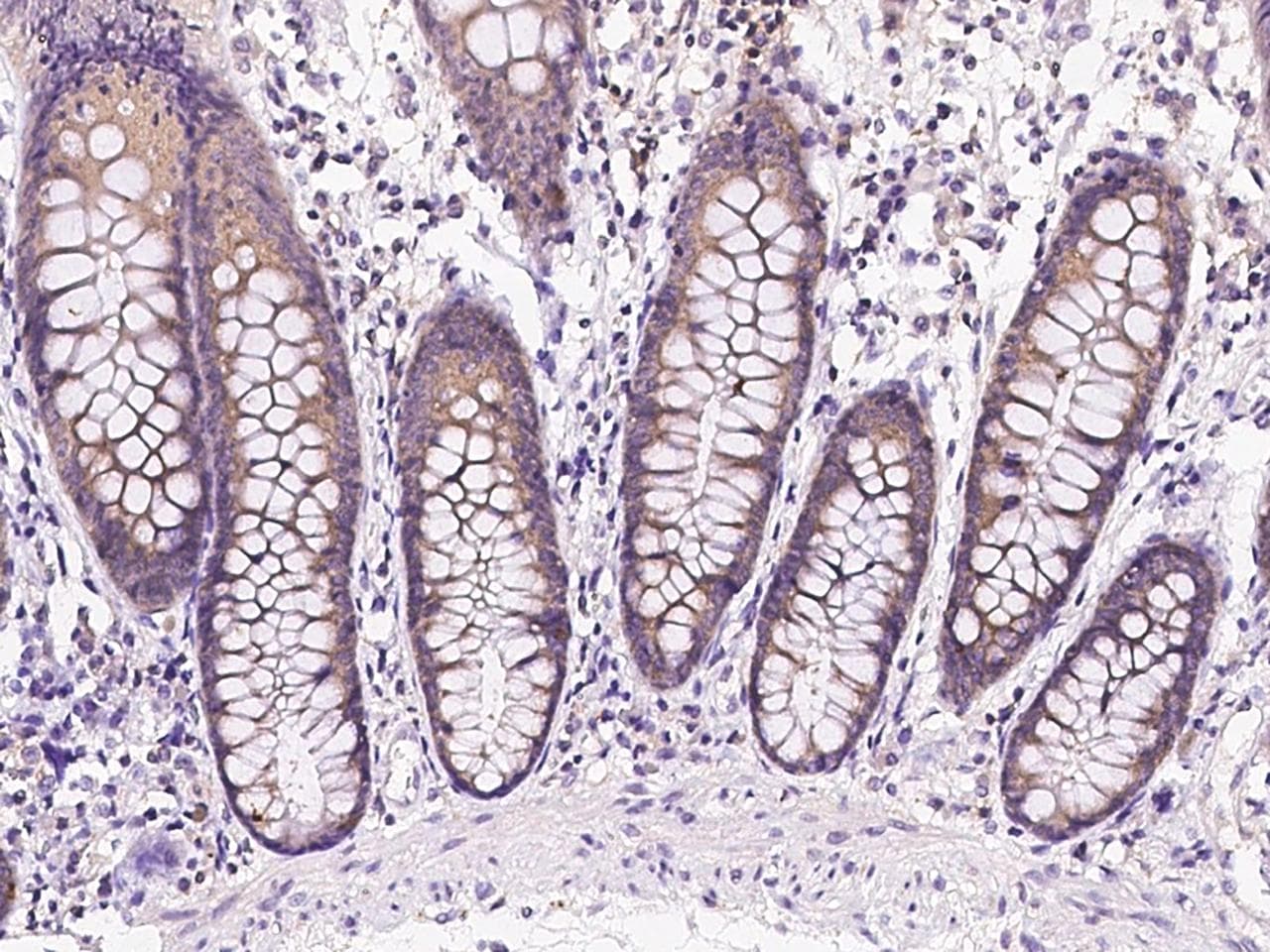 KARS Antibody (Preservative Free)