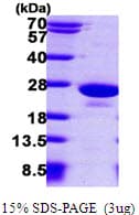 Human PTP4A1 / PRL-1 Protein (Recombinant His)