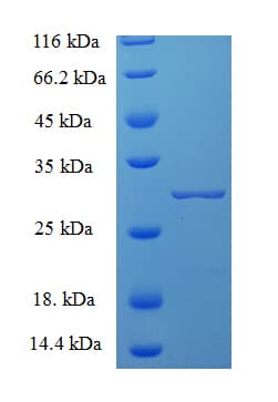 Mouse CMA1 / Mast Cell Chymase Protein (Recombinant 6His, N-terminus)