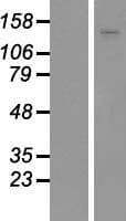 Human ADAMTS18 Protein (Over-Expression Lysate Myc-DDK (Flag))