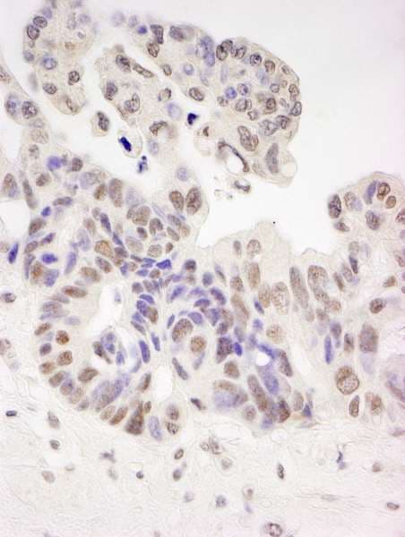 HTATSF1 / TAT-SF1 Antibody (aa375-425)