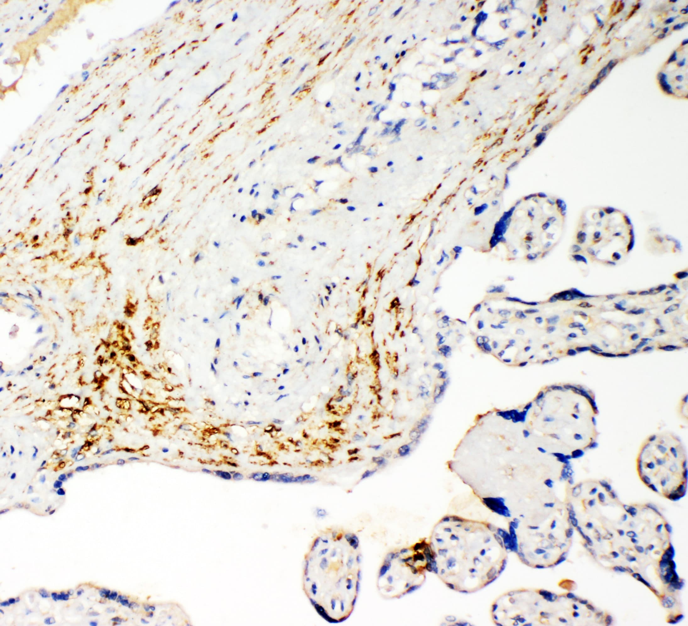 Polyclonal Rabbit anti-Human SLC16A4 Antibody (aa134-148, IHC, WB)