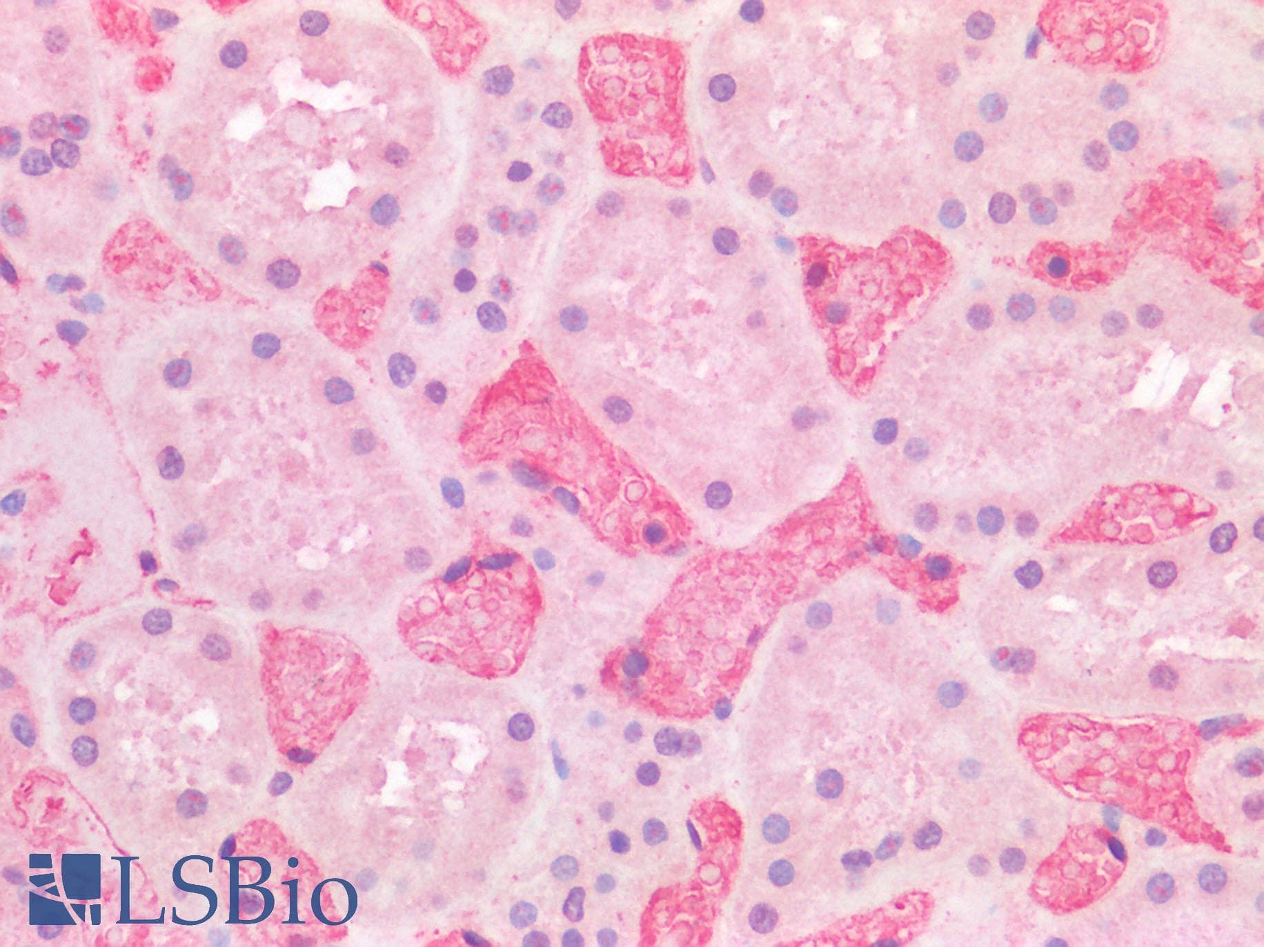 Polyclonal Rabbit anti-Human FCGR3A / CD16A Antibody (IHC, IF)