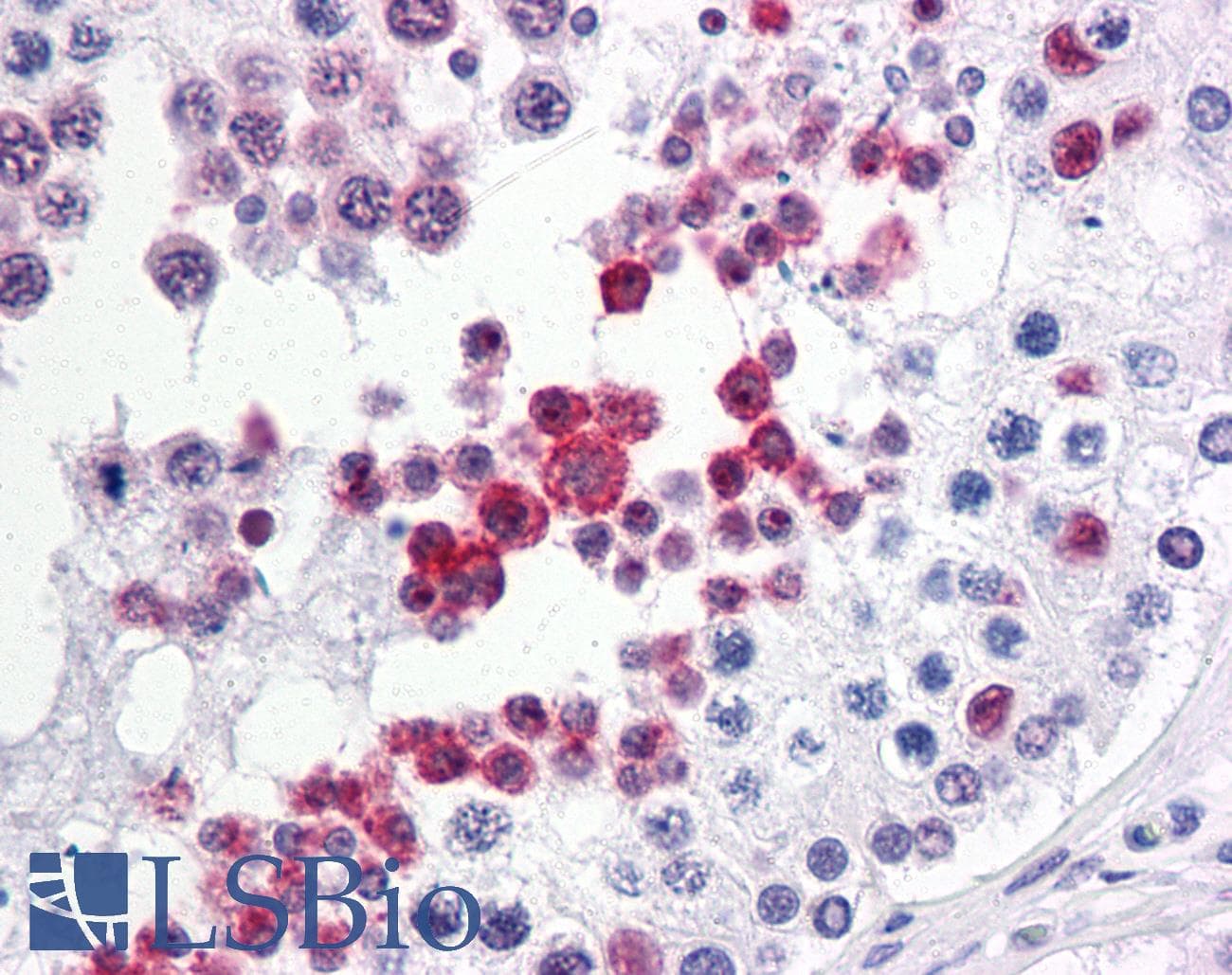 IHC-plus™ PRPK / TP53RK Antibody (clone 4B9-1H3)