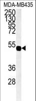 Polyclonal Rabbit anti-Human GJC1 / CX45 / Connexin 45 Antibody (aa89-120, IHC, WB)