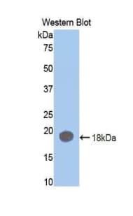 F2 / Prothrombin / Thrombin Antibody (aa201-323)