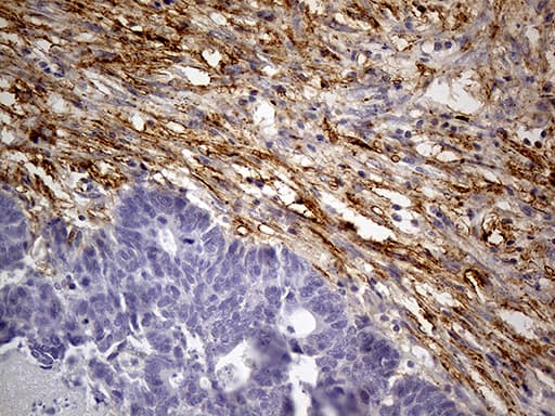 Monoclonal Mouse anti-Human MRC2 / Endo180 Antibody (clone OTI9G4, IHC, WB)