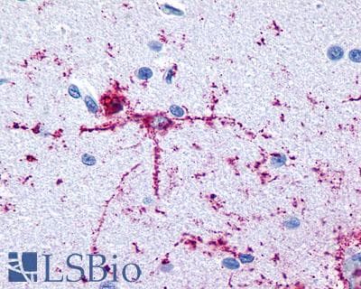 PathPlus™ GRM8 / MGLUR8 Antibody (N-Terminus)