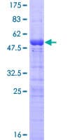 Human NOL5A / NOP56 Protein (Recombinant GST)