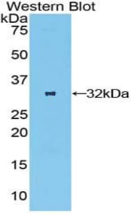 OSMR / IL-31R-Beta Antibody (aa513-760, Biotin)