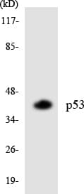 Polyclonal Rabbit anti-Human TP53 / p53 Antibody (aa320-369, WB)