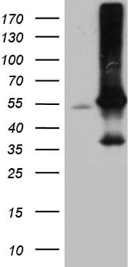 ARIH2 Antibody (aa201-493, clone OTI1B2)