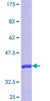 Human PARP1 Protein (Recombinant GST, N-terminus)
