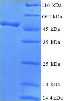 Human RPH3AL Protein (Recombinant His-SUMO)