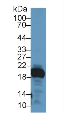 GKN2 / Gastrokine 2 Antibody (aa21-184)