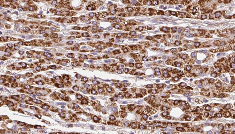 SLC28A1 Antibody