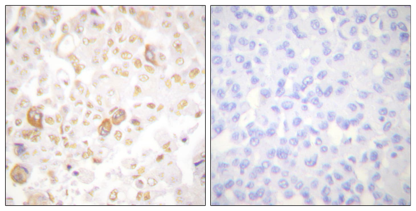 CCNF / Cyclin F Antibody (aa737-786)