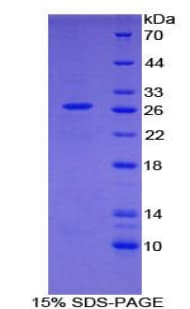Human GAS2 Protein (Recombinant His-T7)