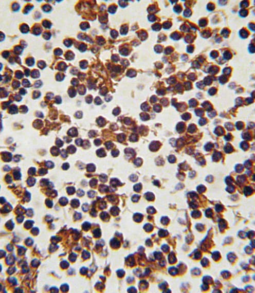 Polyclonal Rabbit anti-Human FOXP3 Antibody (aa283-311, IHC, WB)