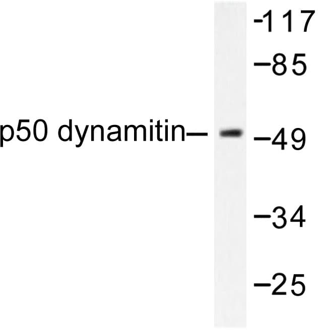 Polyclonal Rabbit anti-Human Dynactin 2 / Dynamitin Antibody (Leu371, IHC, WB)