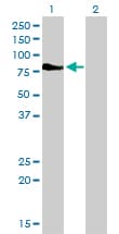 IHC-plus™ Monoclonal Mouse anti-Human DMPK / DM Antibody (clone 2F7, IHC, WB)