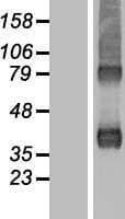 ARPC1B / p41-ARC / ARP2 Protein (Over-Expression Lysate Myc-DDK (Flag))