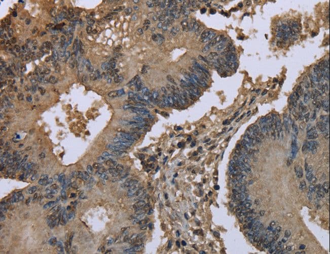 Polyclonal Rabbit anti-Human UBB / Ubiquitin B Antibody (IHC, WB)