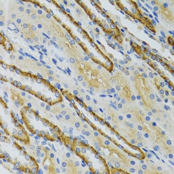 Polyclonal Rabbit anti-Human COG2 Antibody (IHC, WB)
