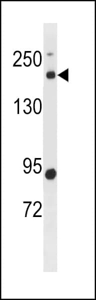 BCL9L Antibody (aa147-176)