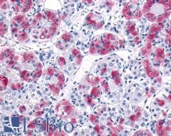 PathPlus™ Polyclonal Rabbit anti-Human MCHR1 Antibody (N-Terminus, IHC)