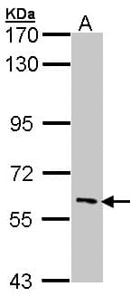 IRAK3 / IRAKM / IRAK-M Antibody (aa58-357)