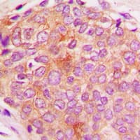 HSPE1 / HSP10 / Chaperonin 10 Antibody (Internal)