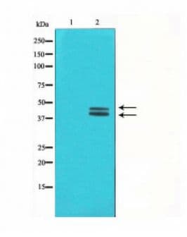 Polyclonal Rabbit anti-Human ERK1 + ERK2 Antibody (phospho-Thr202/Tyr204, IHC, WB)