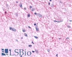 PathPlus™ Polyclonal Rabbit anti-Human MTNR1A / Melatonin Receptor 1a Antibody (Cytoplasmic Domain, IHC)