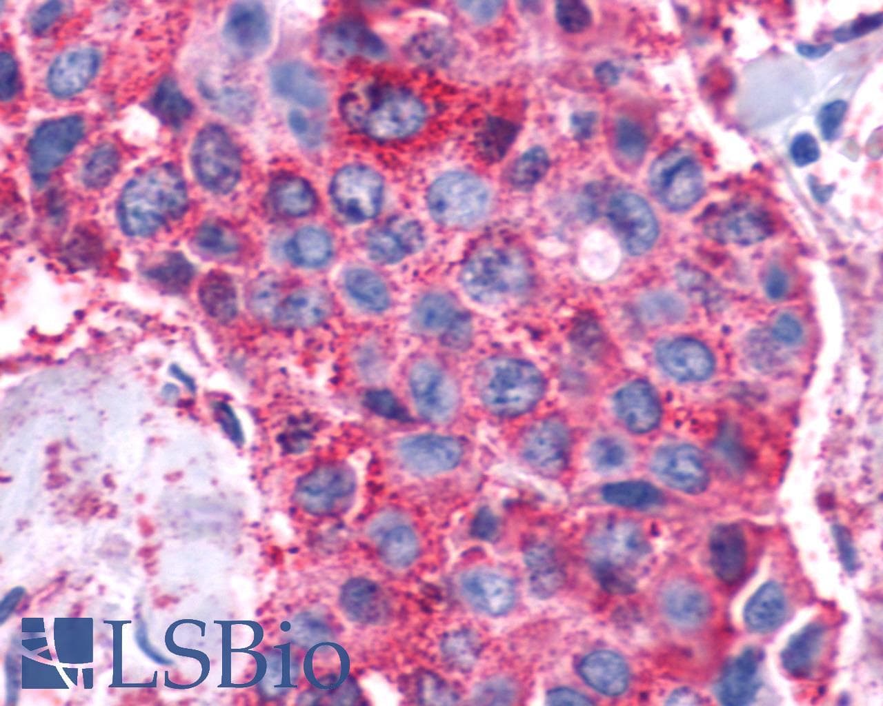 PathPlus™ Polyclonal Rabbit anti-Human VIPR1 Antibody (Cytoplasmic Domain, IHC)