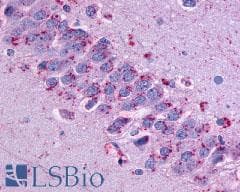 PathPlus™ GPR31 Antibody (Extracellular Domain)
