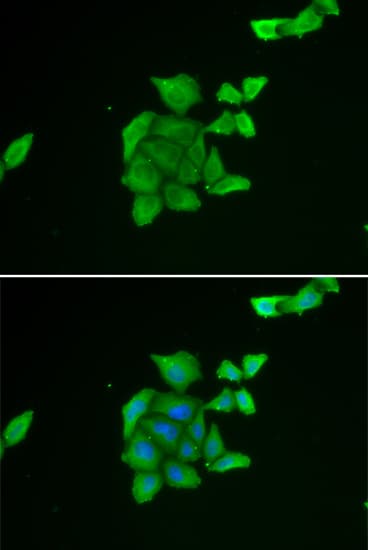 Polyclonal Rabbit anti-Human TUSC2 / FUS1 Antibody (IHC, IF, WB)