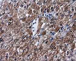 PSMC3 Antibody (clone OTI8D6)