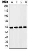 Polyclonal Rabbit anti-Human ZP4 / ZBP Antibody (Internal, WB)