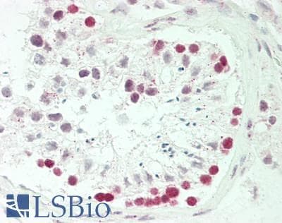 IHC-plus™ Polyclonal Rabbit anti-Human FBL / FIB / Fibrillarin Antibody (aa271-321, IHC, WB)