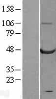 CASQ2 / Calsequestrin 2 Protein (Over-Expression Lysate Myc-DDK (Flag))