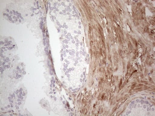 Monoclonal Mouse anti-Human ASPA Antibody (clone OTI3G5, Carrier-free, aa77-313, IHC, WB)