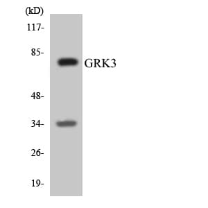 Polyclonal Rabbit anti-Human ADRBK2 / GRK3 Antibody (aa342-391, WB)